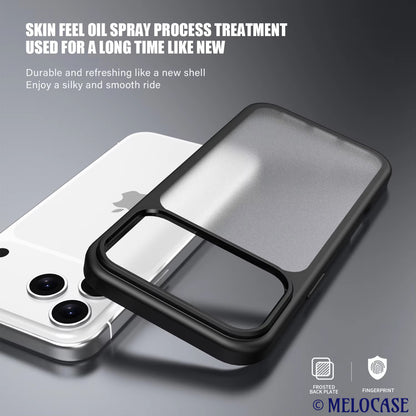 ClearGuard Shockproof Case